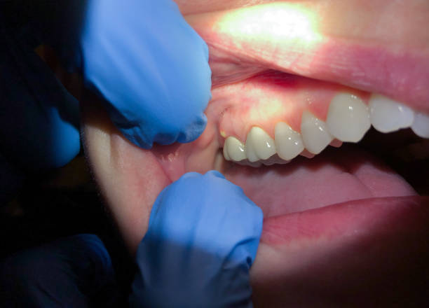  Cottonwood Shores, TX Emergency Dentist Pros