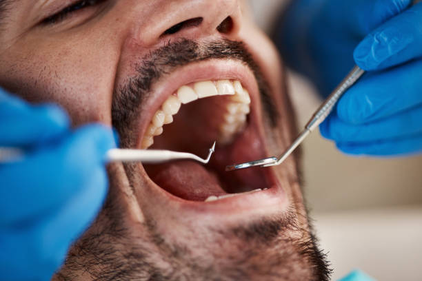 Best Emergency Dental Services for Seniors in Cottonwood Shores, TX