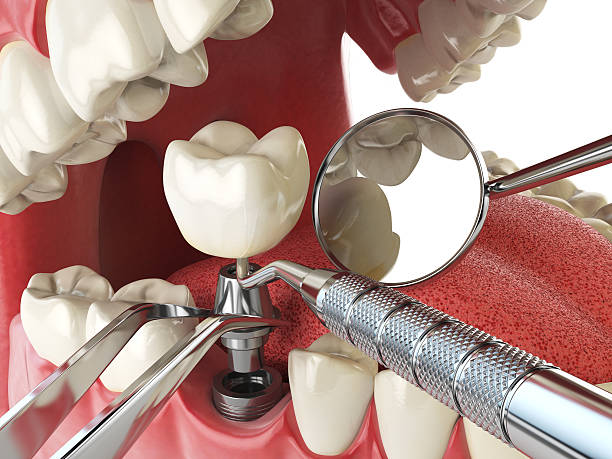 Best Weekend Emergency Dentist in Cottonwood Shores, TX